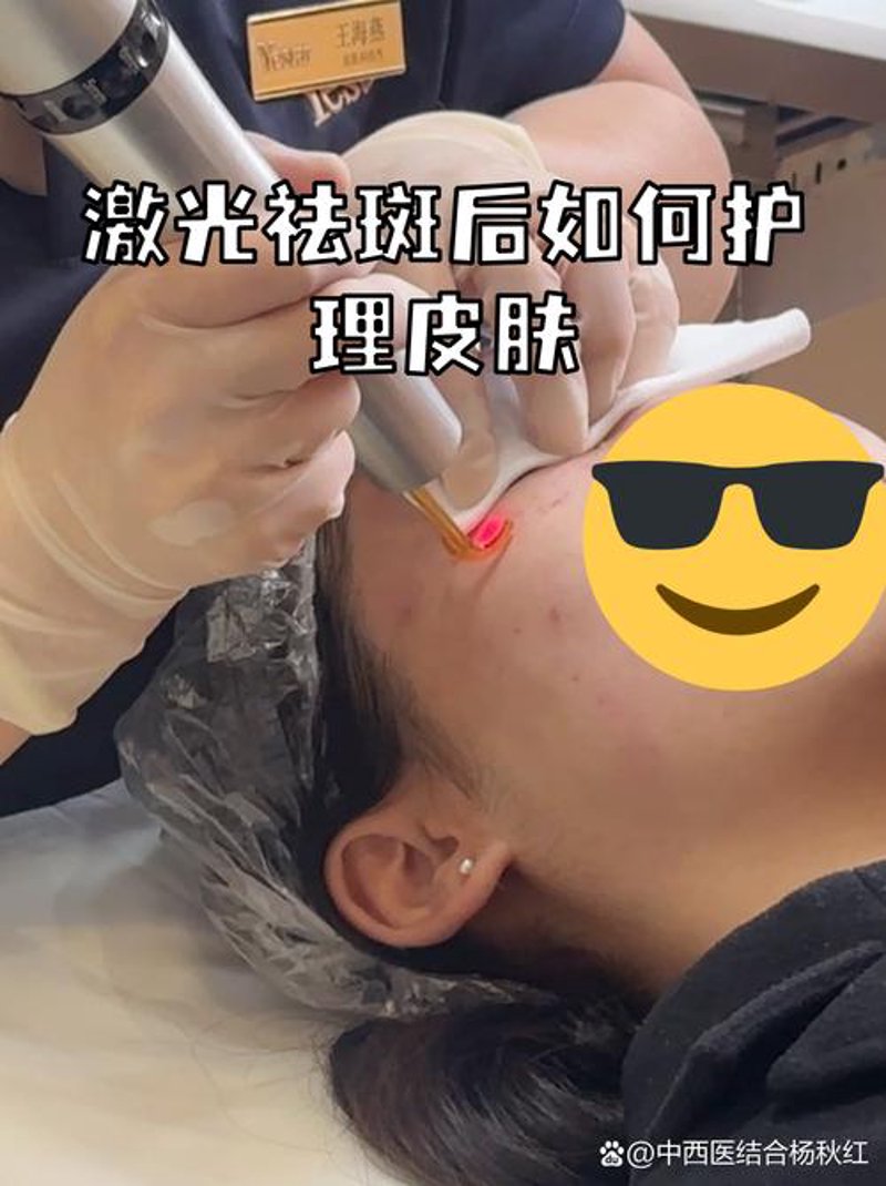 瘦脸针