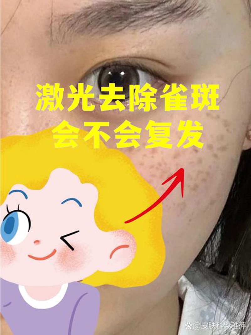 隆鼻整形